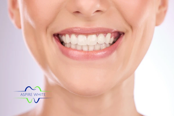 Follow your teeth whitening aftercare Brackley to prolong your whiter smile!